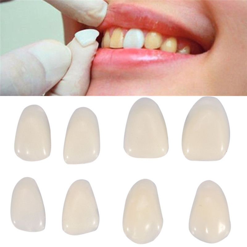 Teeth Whitening Veneers - Dentes falsos dentários, coroa temporária, folheados,