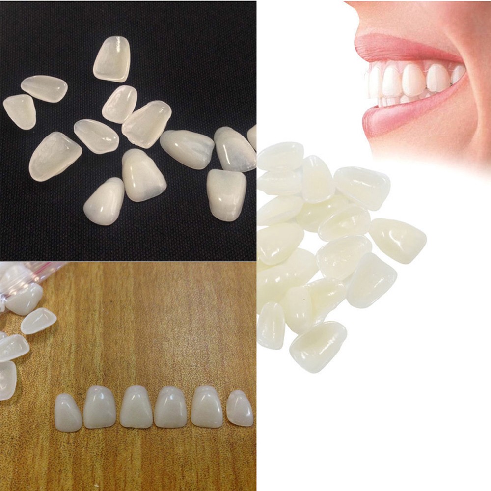 Teeth Whitening Veneers - 70 Peças/Pacote de Facetas Dentárias Estéticas