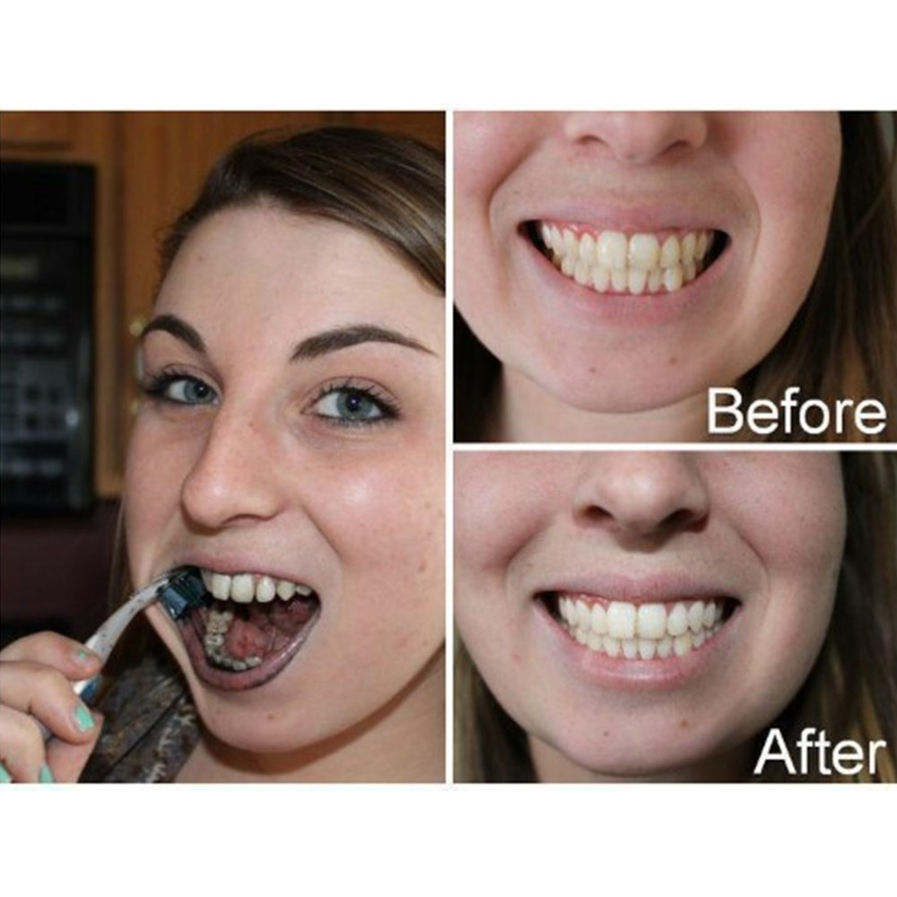 Dentes de carvão vegetal de ba - Teeth Whitening Ingredients avaliação e preço