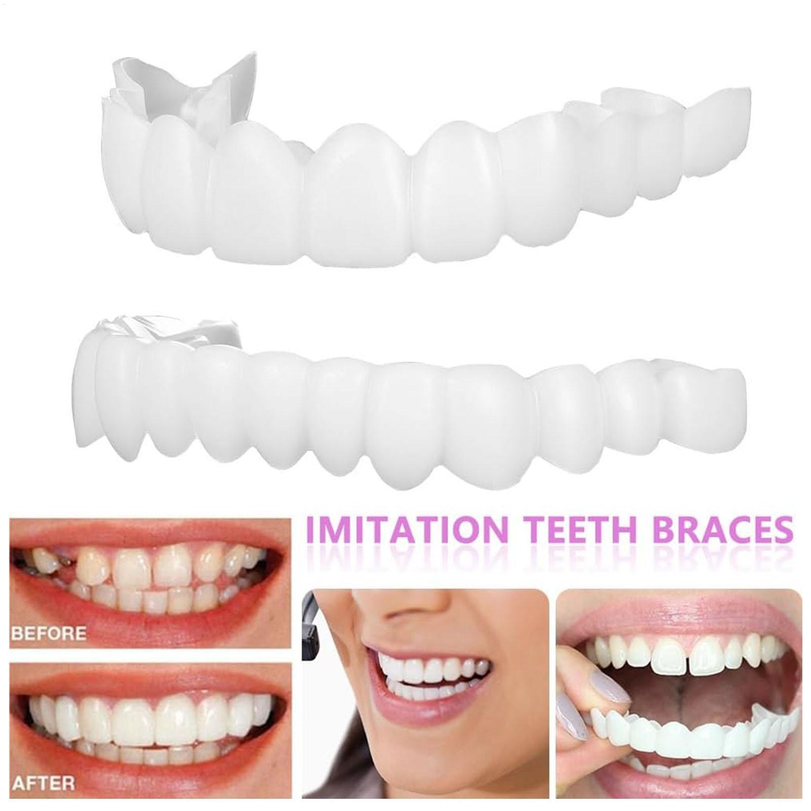 Capa Dentária Superior e Infer - Teeth Whitening Veneers avaliação e preço
