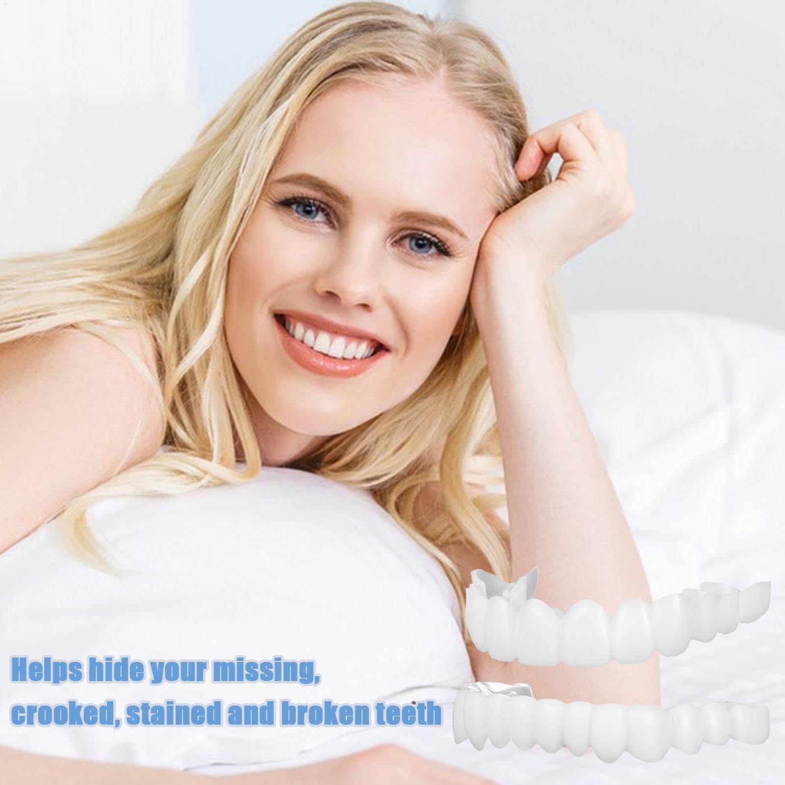 Capa Dentária Superior e Infer - Teeth Whitening Veneers avaliação e preço
