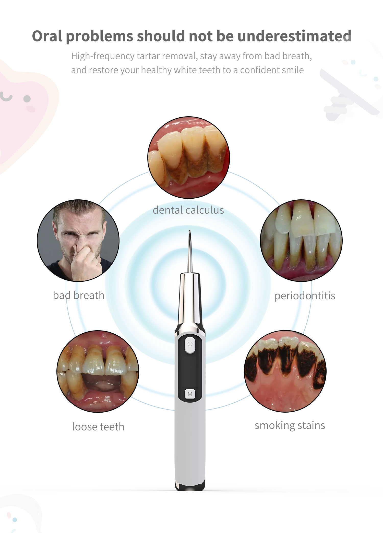 Raspador de cálculo dental sôn - Teeth Whitening Or Tooth Whitening avaliação e preço