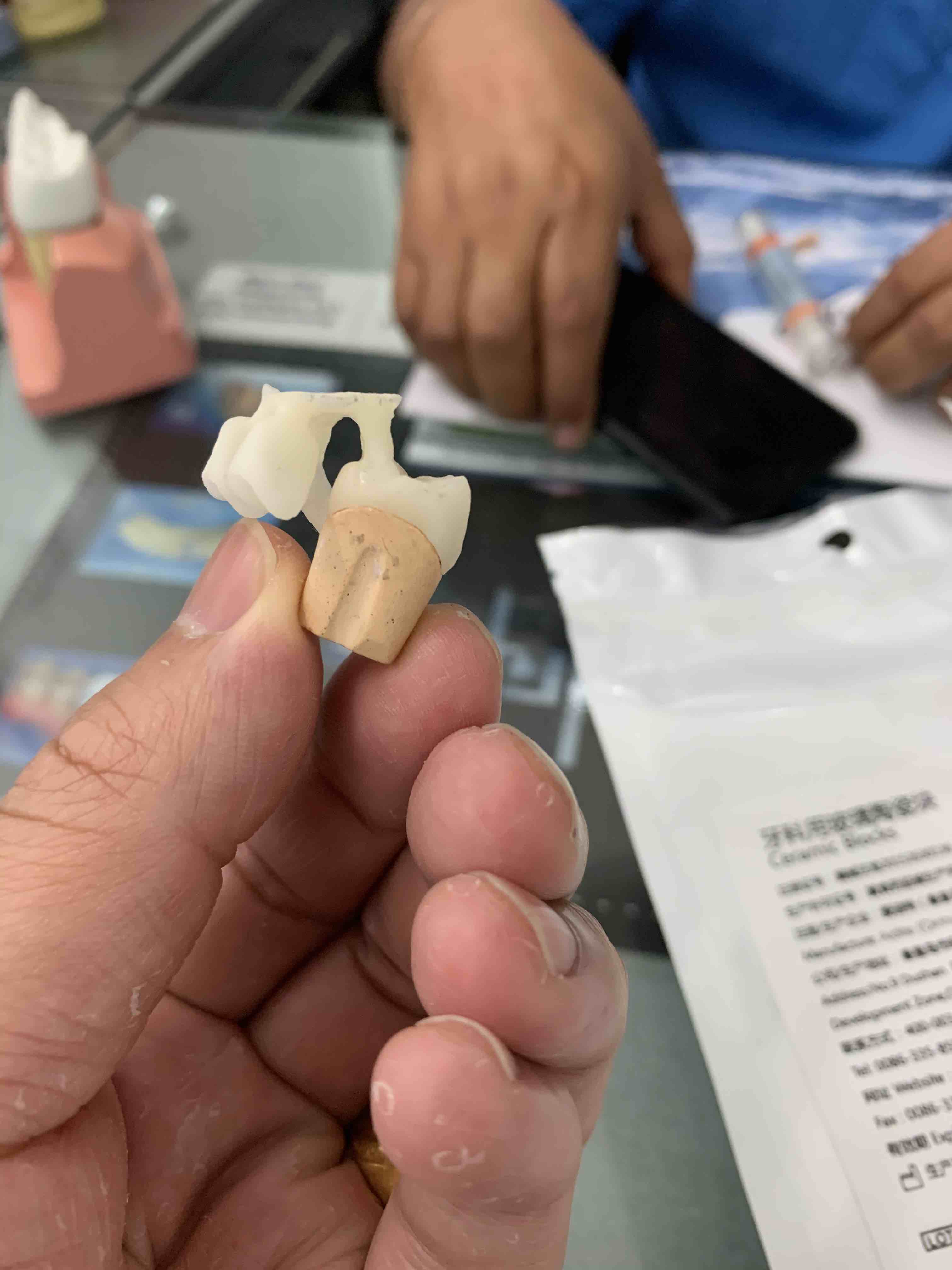 Lingote cerâmico de vidro dent - Teeth Whitening Veneers avaliação e preço
