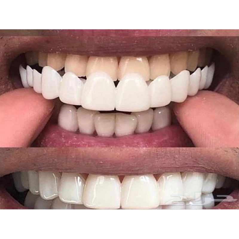 Gel de silicone macio dental o - Teeth Whitening Moulds avaliação e preço