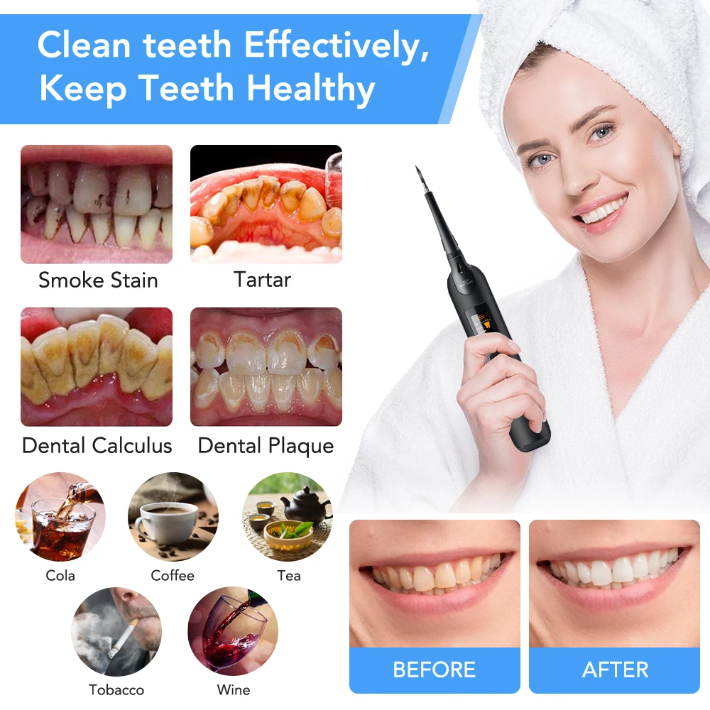 Conjunto de escova de dentes e - Teeth Whitening Or Tooth Whitening avaliação e preço