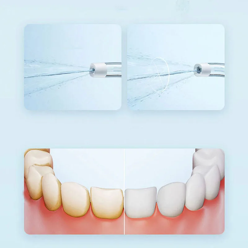 Irrigador Oral Portátil Xiaomi - Teeth Whitening Or Tooth Whitening avaliação e preço