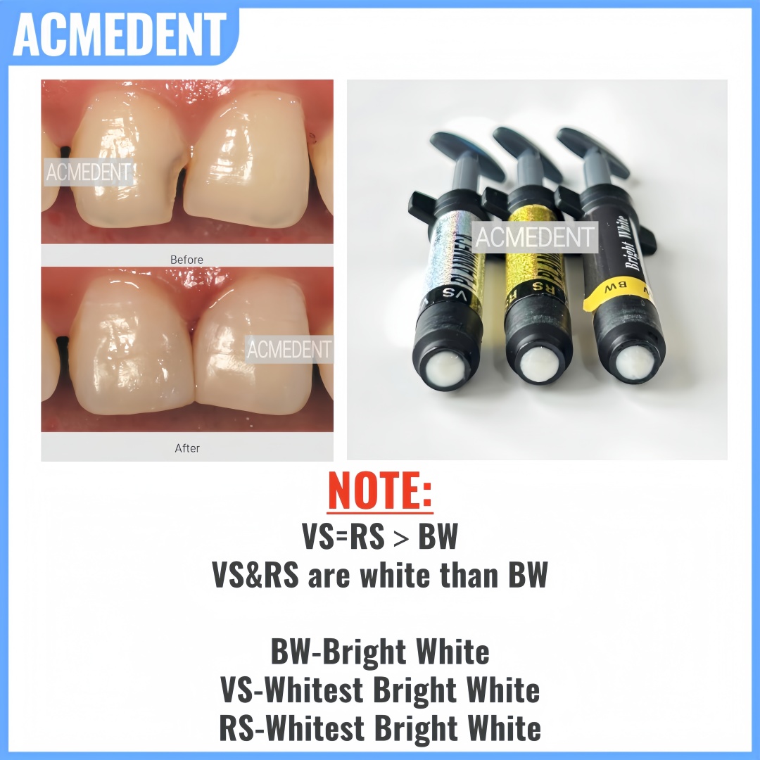 Folheado de resina composta de - Teeth Whitening Vs Veneers avaliação e preço