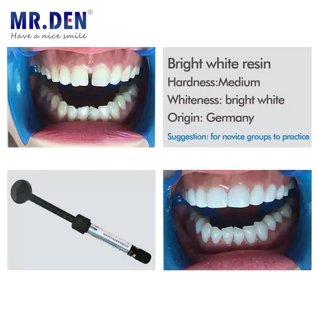 Nano esmalte folheado material - Teeth Whitening Veneers avaliação e preço