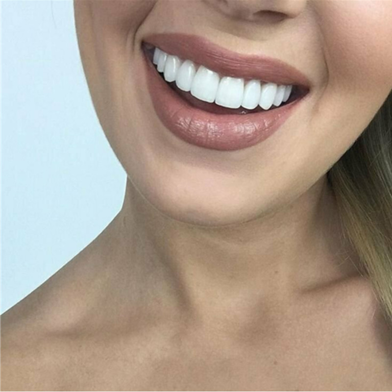 Veneers Clareadores de Dentes, - Teeth Whitening Veneers avaliação e preço