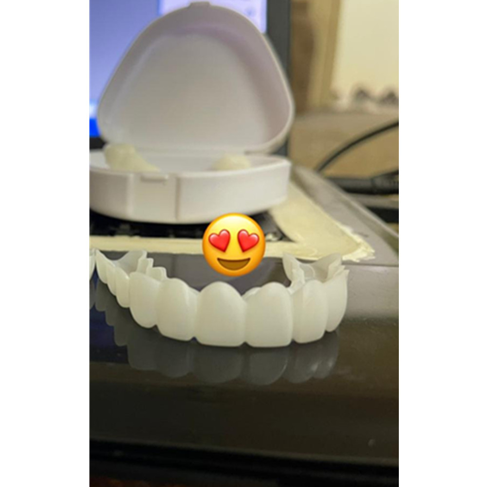 On Smile Dental Cobertura para - Teeth Whitening Veneers avaliação e preço